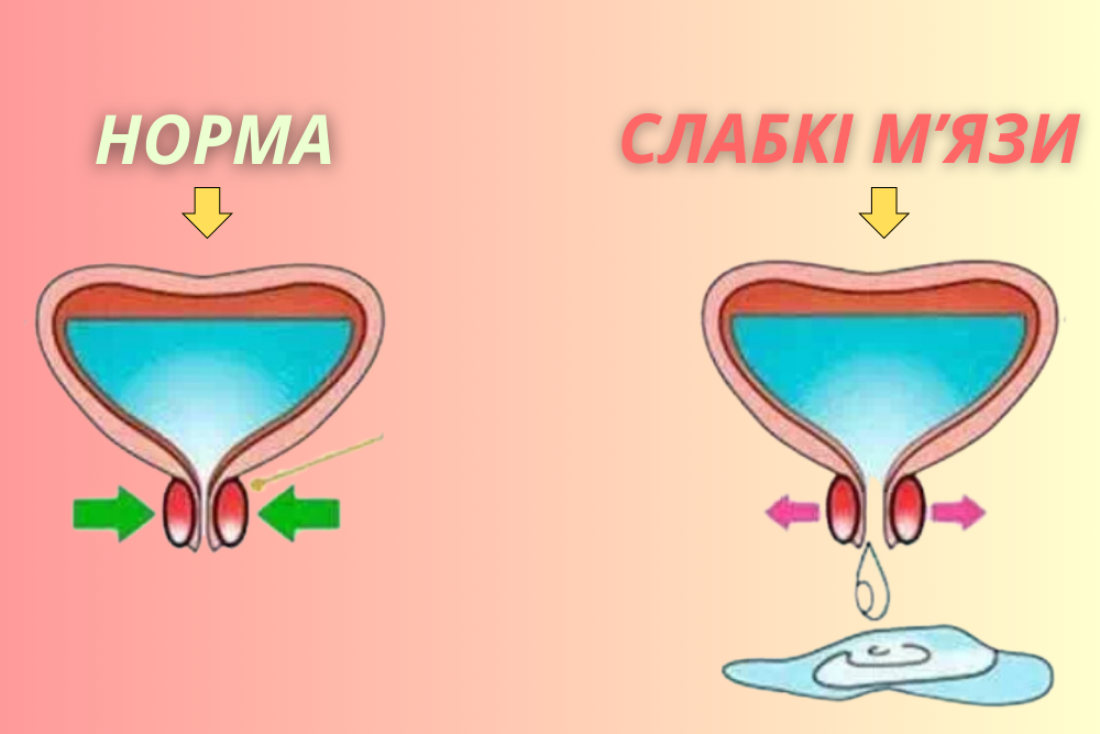 Схема